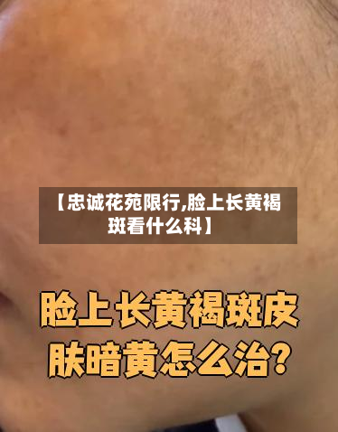 【忠诚花苑限行,脸上长黄褐斑看什么科】